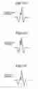 Fig. 17 - Image forming apparatus that detects image shift in the main scanning direction without wasting toner