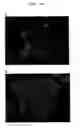 Fig. 09 - Agent for promoting corneal endothelial cell adhesion