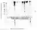 Fig. 01 - Antibodies for oncogenic strains of HPV and methods of their use