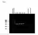 Fig. 07 - Recombinant 15-kDa polypeptide and use of same in detecting human infection with 