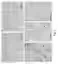 Fig. 08 - METHOD, DEVICE AND KIT FOR DETERMINING CONDITIONS RELATED TO A DYSFUNCTION OF THE RENAL PROXIMAL TUBULE