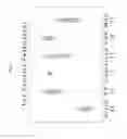 Fig. 02 - BIOMARKERS ASSOCIATED WITH NEPHROPATHY