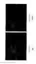 Fig. 02 - TUMOUR-CELL-FIXING CELLS