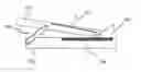Fig. 01 - Resilient lever for a flip top device