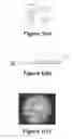Fig. 02 - Light Transmitted Assay Beads