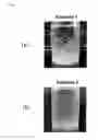 Fig. 02 - Swellable crosslinked hyaluronan powder and method for producing the same