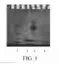 Fig. 02 - Modified recombinant human endostatin and uses thereof