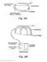 Fig. 03 - Transcranial magnetic stimulation (TMS) methods and apparatus