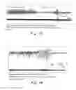 Fig. 14 - Transcranial magnetic stimulation (TMS) methods and apparatus