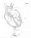 Fig. 02 - Guidable intravascular blood pump and related methods