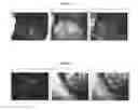 Fig. 04 - Optical System for Imaging of Tissue Lesions