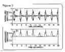 Fig. 04 - Respiratory signal detection and time domain signal processing method and system