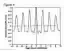 Fig. 05 - Respiratory signal detection and time domain signal processing method and system