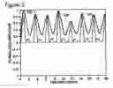 Fig. 06 - Respiratory signal detection and time domain signal processing method and system