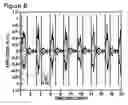 Fig. 09 - Respiratory signal detection and time domain signal processing method and system