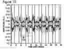 Fig. 11 - Respiratory signal detection and time domain signal processing method and system