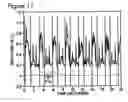 Fig. 12 - Respiratory signal detection and time domain signal processing method and system