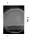 Fig. 07 - Methods and devices for quantitative analysis of bone and cartilage