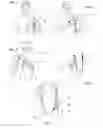 Fig. 03 - Shoulder orthosis