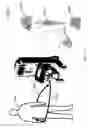 Fig. 11 - PROCESSING BLOOD