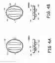 Fig. 05 - Skin treatment apparatus for personal use and method for using same