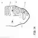 Fig. 16 - Skin treatment apparatus for personal use and method for using same