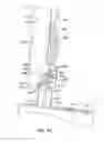 Fig. 35 - Apparatus and methods for self-administration of vaccines and other medicaments