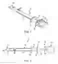 Fig. 02 - Balloon catheter inflation apparatus and methods