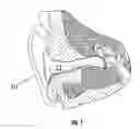 Fig. 02 - Vestibular stimulation apparatus and associated methods of use
