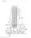 Fig. 02 - Partially biodegradable stent