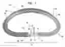Fig. 02 - Actively-engageable movement-restriction mechanism for use with an annuloplasty structure