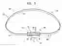 Fig. 04 - Actively-engageable movement-restriction mechanism for use with an annuloplasty structure
