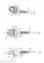 Fig. 02 - Humeral prosthesis
