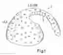 Fig. 02 - Thermally Sprayed Surface Layer As Well As An Orthopedic Implant