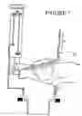 Fig. 07 - Universal flush valve kit and method of using