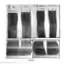 Fig. 06 - Composition for permanent or semipermanent tinting of keratin fibers with oil-in-glycol lamellar gel