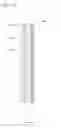 Fig. 09 - MASCARA BRUSH