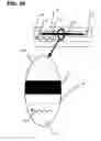 Fig. 11 - CRYOPRESERVATION METHOD AND DEVICE