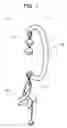 Fig. 02 - Supporting earring along root of ear