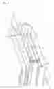 Fig. 09 - Pivoting Handle Installation Tool for Assembling Pre-tension Spiral Balances into Window Frames
