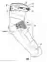 Fig. 02 - Arm Guards