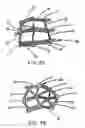 Fig. 03 - Intraluminal stent graft
