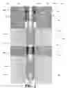 Fig. 04 - Method and system using zeta potential altering compositions as aggregating reagents for sand control
