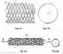 Fig. 02 - BIOABSORBABLE STENTS WITH REINFORCED FILAMENTS