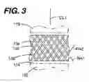 Fig. 04 - Reinforced stripper rubber body and method of making same