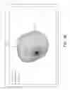 Fig. 09 - Antenna with double groundings