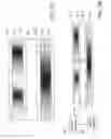 Fig. 02 - Image display capable of being an electronic curtain
