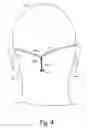 Fig. 04 - Temple-bar-less eyeglasses