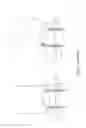 Fig. 02 - Detachable capacitor device