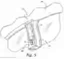Fig. 06 - Concealed interior lighting for automobiles